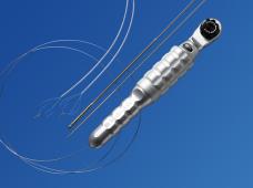 Lithotripsy / Extraction