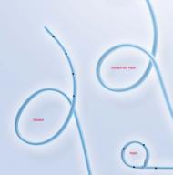 Nasobiliaire Drainage