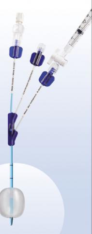 Stone Extraction Balloons